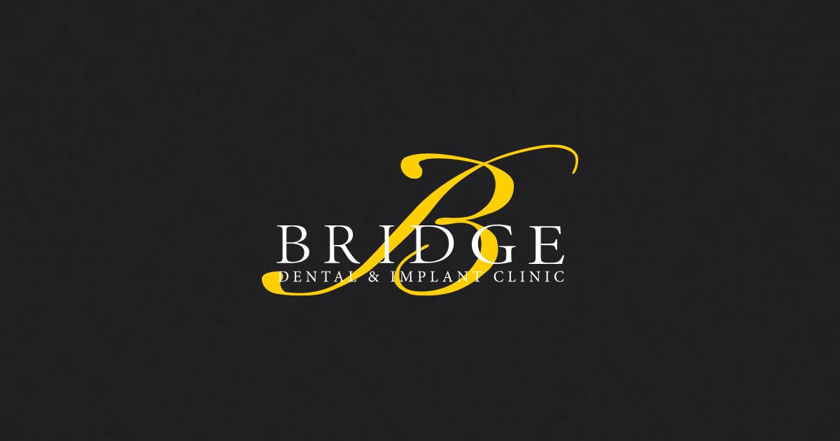 Composite bonding Derby bridge dental implant clinic BISU