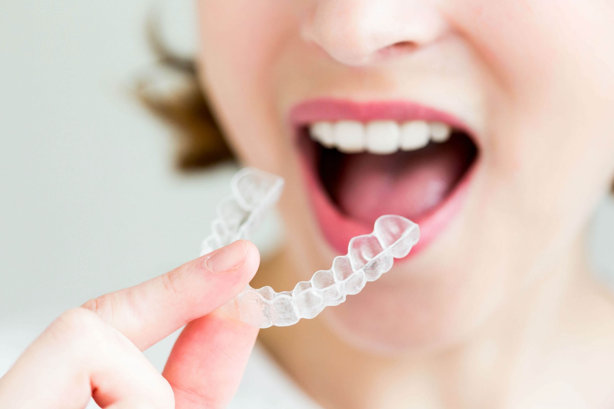 Invisalign Dunfermline the linden tree dental lounge BISU