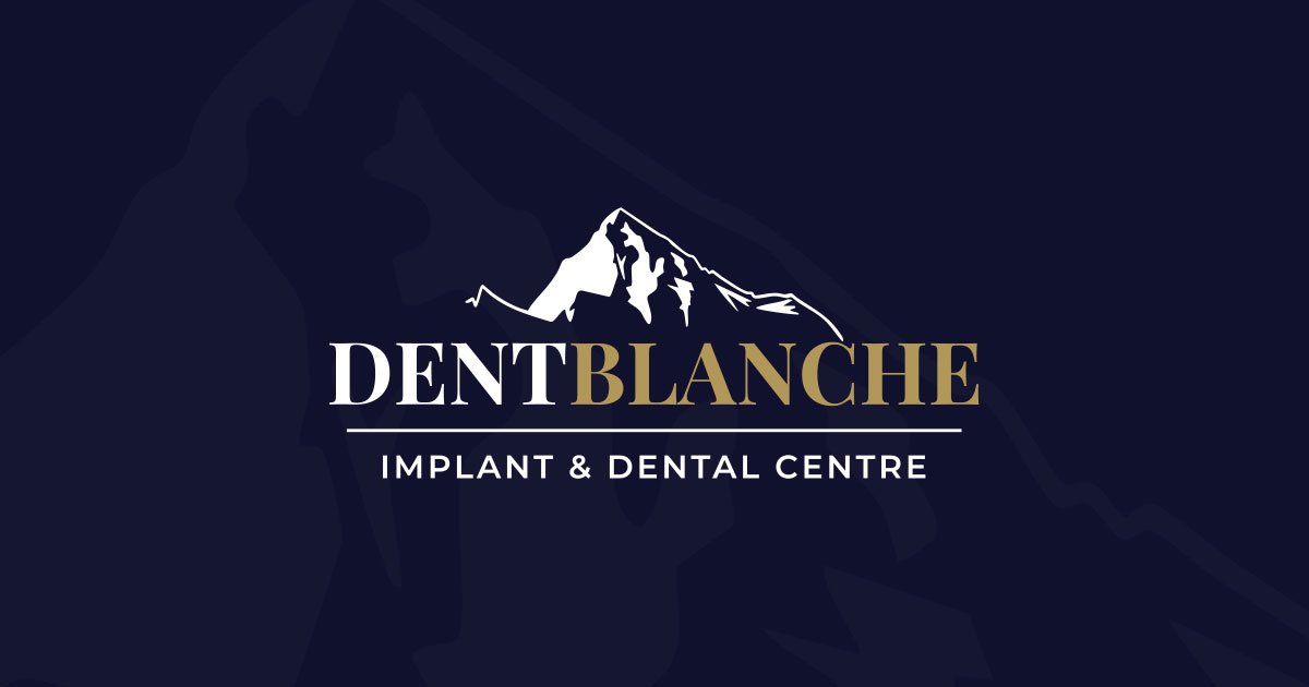 Dental implants Bingham Dent Blanche BISU