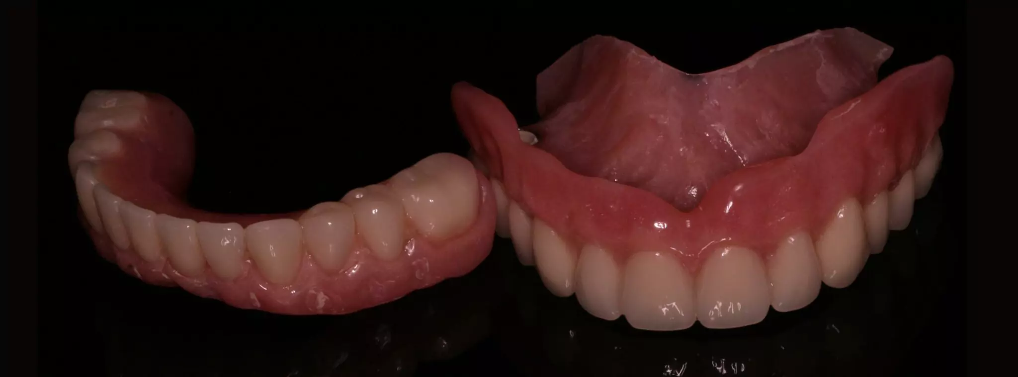 Dentures Leeds Leeds Dental Clinic BISU